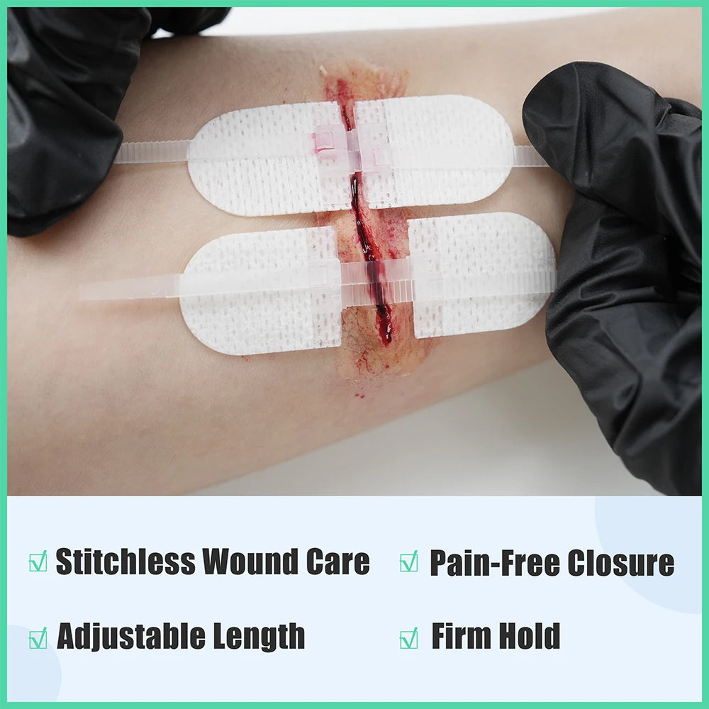Rhino Rescue Emergency Wound Closure Strip Kit Laceration Repair